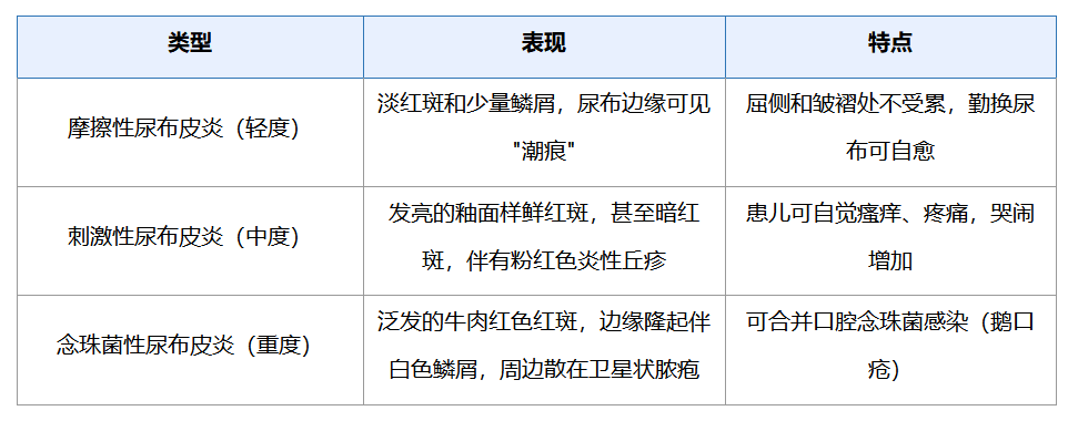 天气热，用尿不湿太容易闷出红屁屁，该怎么办？